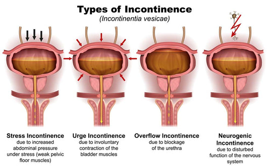 Incontinence Issues with PSP